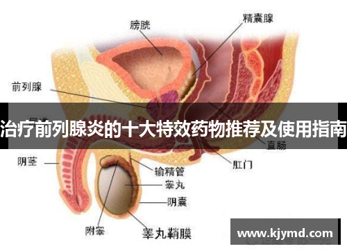 治疗前列腺炎的十大特效药物推荐及使用指南